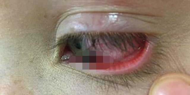 The lead in the girl's eye.