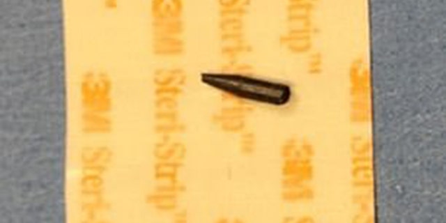 A piece of lead removed from the girl's eye.