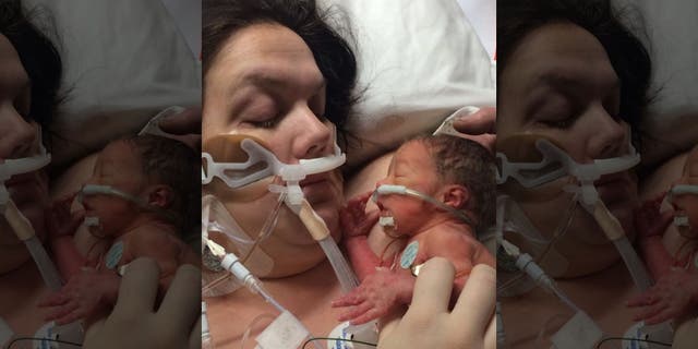 Sharee McCoy suffered massive blood loss after giving birth to son Luka and needed life-saving surgery.
