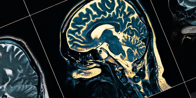 For those who were told their Parkinson’s was another disease — or all in their head — the experience can be devastating.