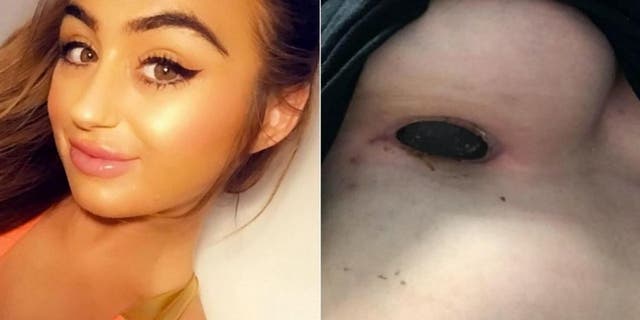 Plastic surgery horror stories: 7 botched procedures that made the news in  2019