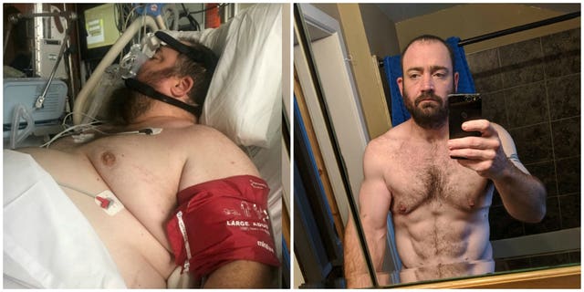 (L-R) Adam Harris in hospital before his dramatic weight loss in 2017 and in fantastic shape in 2019.