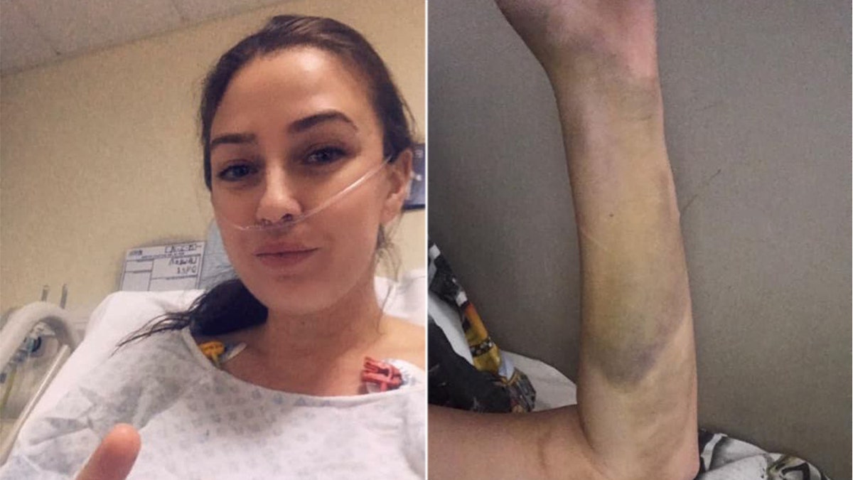 Lauren Dyer says the birth control pills she was taking led her to develop two "massive" blood clots that affected her lungs.
