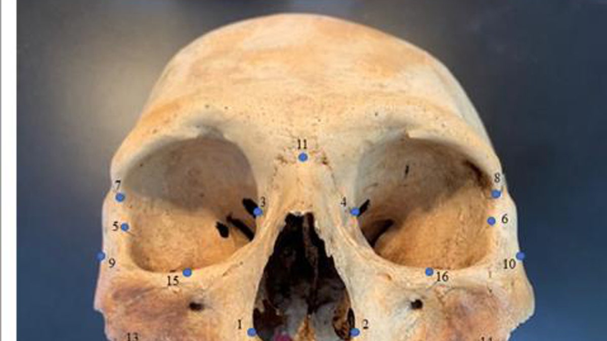 Researchers analyzed the skulls of early Caribbean inhabitants, using 3D facial "landmarks" as a genetic proxy for determining how closely people groups were related to one another. (Credit: Ann Ross/North Carolina State University)