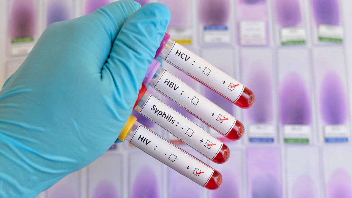 Four test tubes held by gloved hand in front of purple charts.