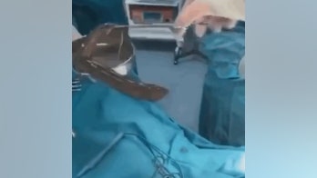 Man tried to cure constipation by swallowing live eels, wound up in emergency surgery, report says