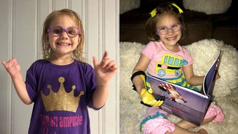 Alabama girl, 4, who lost fingers to exploding light bulb gets prosthetic hand: 'It's changed her life'