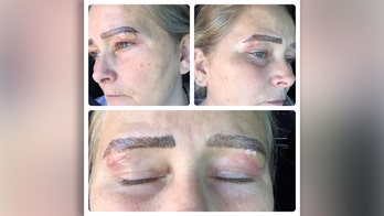 Michigan woman claims microblading left her with infected blisters under eyebrows