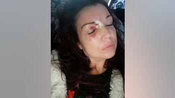 Mom says she nearly lost eye after Christmas present she bought son shot into face