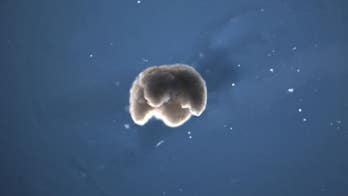 Tiny 'xenobots' made from cells could heal our bodies and clean the environment