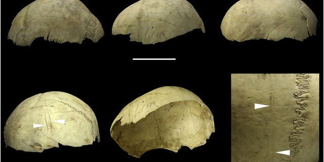 Human skulls were systematically manufactured as recently as the Bronze Age to make pots and drinking cups, new research shows. Meticulous extraction of the scalp and flesh was used to clean the skulls and turn them into bowls, personalised decorations and war trophies as recently as 4,000 years ago. (Credit: SWNS)