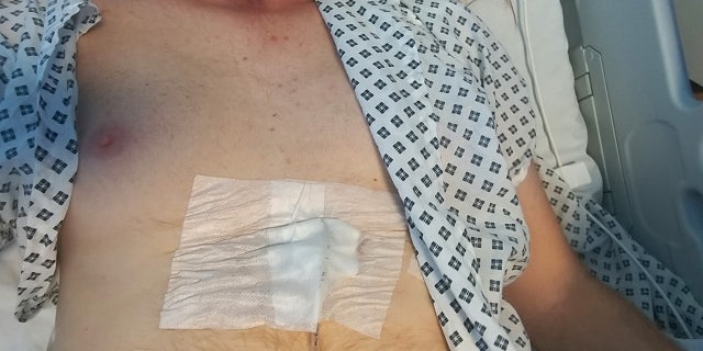 Jonathan Jenkyn while undergoing treatment.