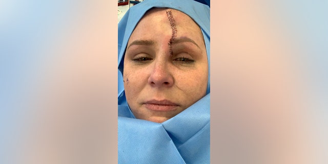 Carrie Searcy following surgery.