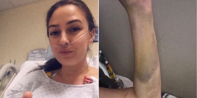 Lauren Dyer says the birth control pills she was taking led her to develop two "massive" blood clots that affected her lungs.