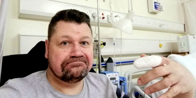 Steven MacDonald after his finger was treated.
