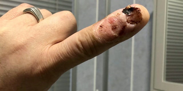 "To any nail biters out there, please just pull your finger away from your teeth," MacDonald said.