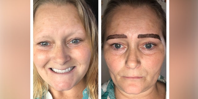 Shannon Bozell of Michigan, pictured before and immediately after the mircoblading, said she trusted the artist to choose the correct shape for her face.?