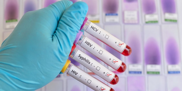 Blood sample positive with sexually transmitted diseases: HIV, HBV, HCV, Syphilis
