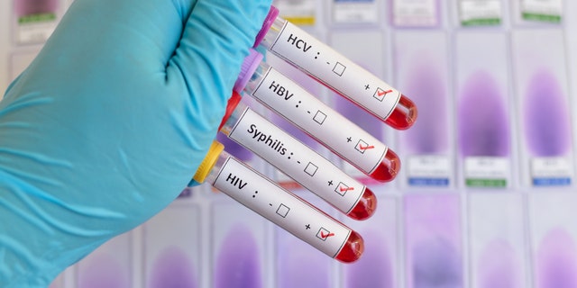 Blood sample positive with sexually transmitted diseases: HIV, HBV, HCV, Syphilis