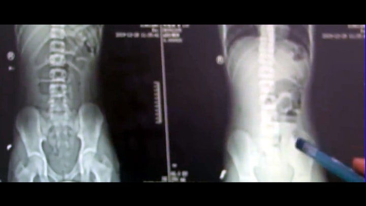 Fox News Flash top headlines for Jan. 17