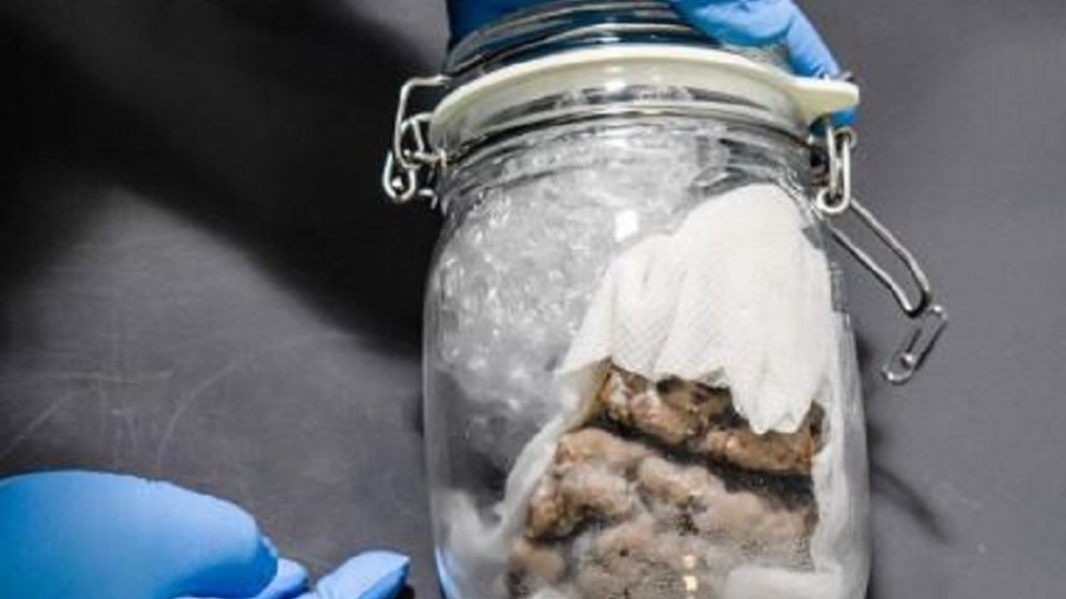 Customs and Border Protection officers found a human brain in a Canadian mail shipment last week.