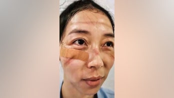 Medics treating coronavirus patients share toll illness is taking