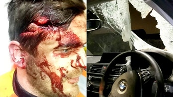 Driver struck in head by tow hitch that smashed through his car's windshield