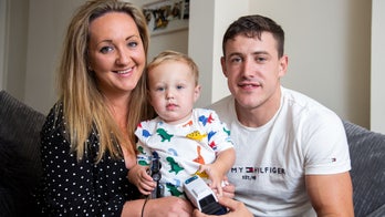 Boy with rare birth defect has skull separated, pieced back together in real-life 'Humpty Dumpty' case