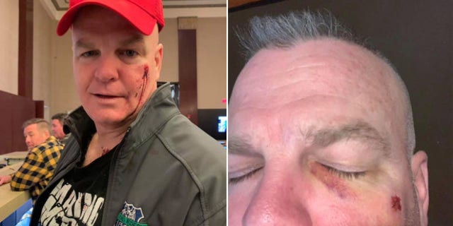 Westlake Legal Group dann Retired NYPD cop says he was assaulted in Nashville bar over ‘Make 50 Great Again’ birthday hat: report fox-news/us/us-regions/southeast/tennessee fox-news/us/crime/police-and-law-enforcement fox-news/us/crime fox-news/travel/vacation-destinations/new-york-city fox news fnc/us fnc Dom Calicchio article 67b0362b-423d-59b0-be47-9cf4fa64c934