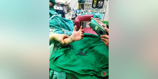 Shaurya Undre's newly re-attached hand.