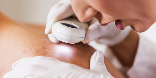 Westlake Legal Group iStock-514880133 What is skin cancer? How to spot the signs and when to seek help Madeline Farber fox-news/health/cancer/skin-cancer fox-news/health/beauty-and-skin fox news fnc/health fnc article 3ae6cb7c-509b-5d59-bef7-cdb208e68589