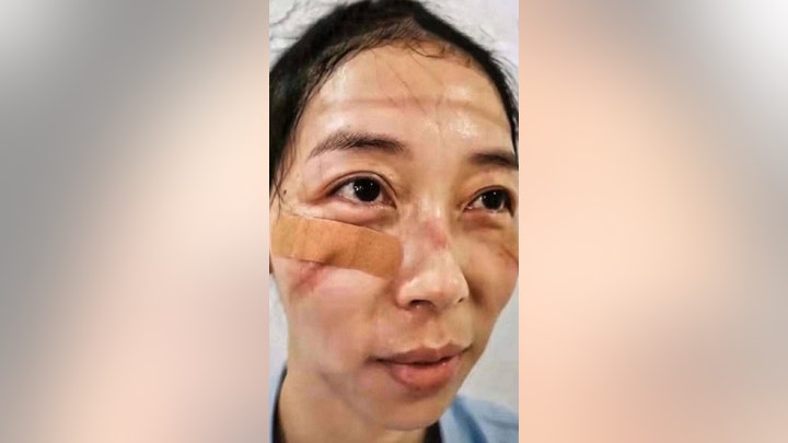 Second coronavirus death reported outside Chinese mainland