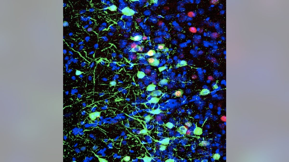 Pyramidal cells in the mouse prelimbic cortex (shown in blue) that were active during the formation of a discrete memory (shown in green).