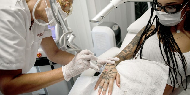 How To Remove A Tattoo The Options Risks And Costs Associated With