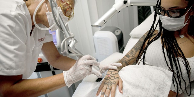 A heavily tattooed woman in Berlin undergoes laser removal treatment for unwanted tattoos on her hand and thigh.