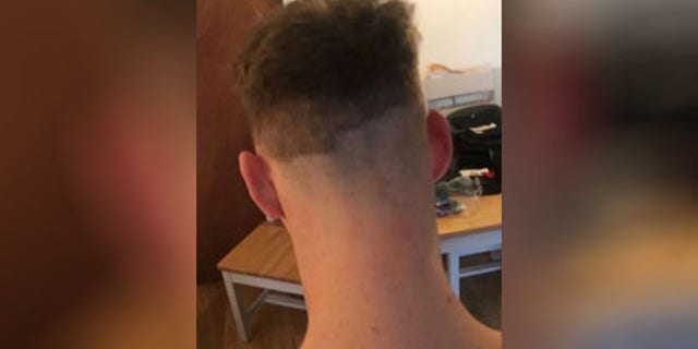 Matt, 20, apparently had some trouble with the back of his head.