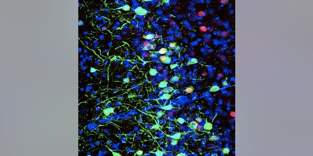 Pyramidal cells in the mouse prelimbic cortex (shown in blue) that were active during the formation of a discrete memory (shown in green).