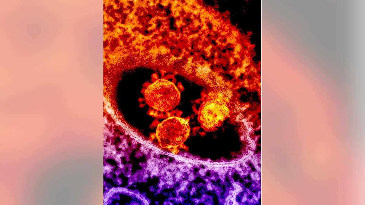 Colorized transmission electron micrograph showing particles of the Middle East Respiratory Syndrome Coronavirus that emerged in 2012.