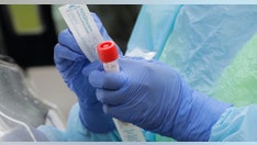 CDC study suggests coronavirus can travel 13 feet in air and live on shoes