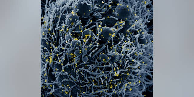 Colorized scanning electron micrograph of an apoptotic cell (blue) infected with SARS-COV-2 virus particles (yellow), isolated from a patient sample. Image captured at the NIAID Integrated Research Facility (IRF) in Fort Detrick, Maryland. NIAID