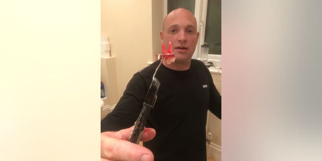 Billy Taylor with the tooth he removed himself. (SWNS)