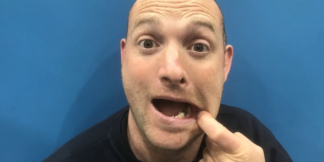 Billy Taylor shows where he removed his tooth.
