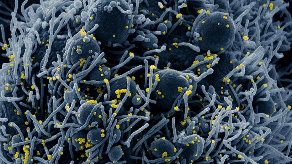 Colchicine In Covid19 An Old Drug New Use