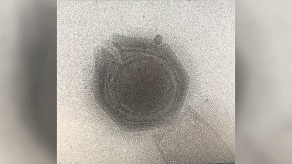 Microscopic image of an open Tupanvirus particle, a type of giant virus (Credit: Parent Lab at Michigan State University)