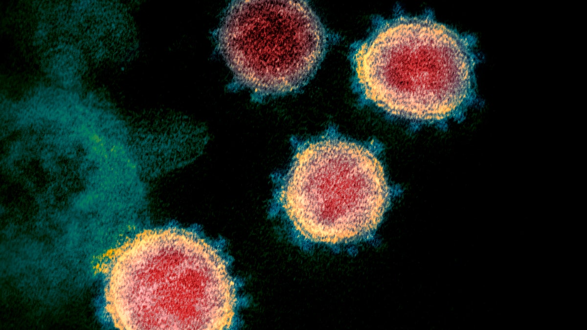 This electron microscope image made available by the U.S. National Institutes of Health in February 2020 shows the coronavirus that causes COVID-19. The sample was isolated from a patient in the U.S. (NIAID-RML via AP)