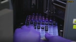 Coronavirus patients beware: Plasma therapy may not be the best treatment for you