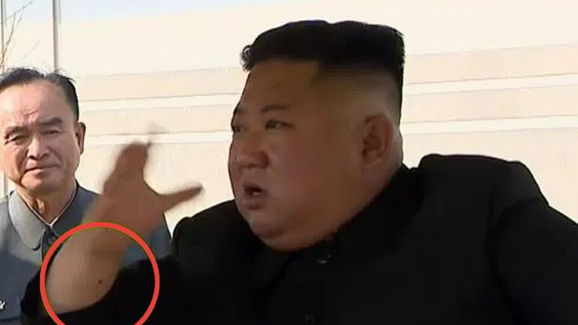 Kim-Jong-Un-Wrist-Mark-NK-News.jpg