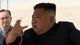 Kim Jong Un may have had heart surgery, based on fresh mark on wrist, experts say