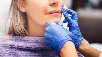 'Maskne': Suffering from acne or breakouts under your mask? Here's what to do