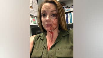 California retail employee posts photo of her bloody face after alleged customer attack